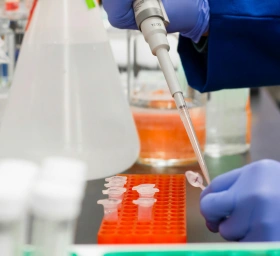 Bild Was sind Anti-Nephrin-Antikörper und welche Rolle spielen sie bei chronischen Nierenerkrankungen?